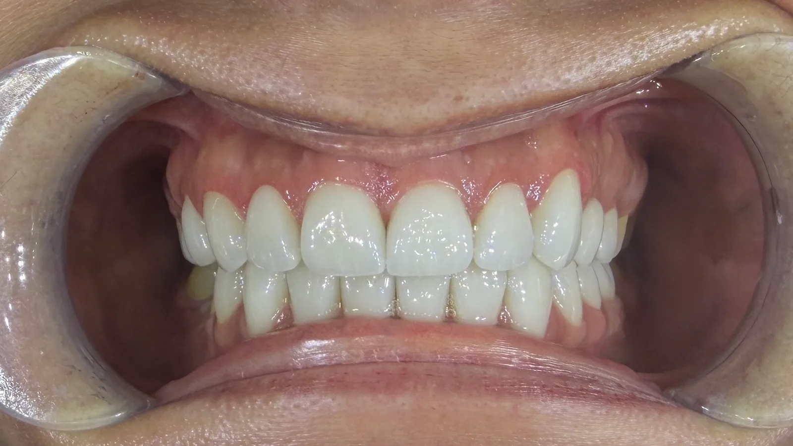 Denteca Smile Clinic - stomatologie premium București