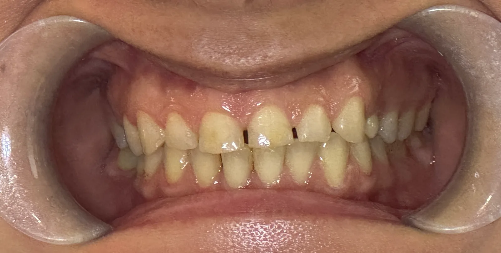 Denteca Smile Clinic - stomatologie premium București