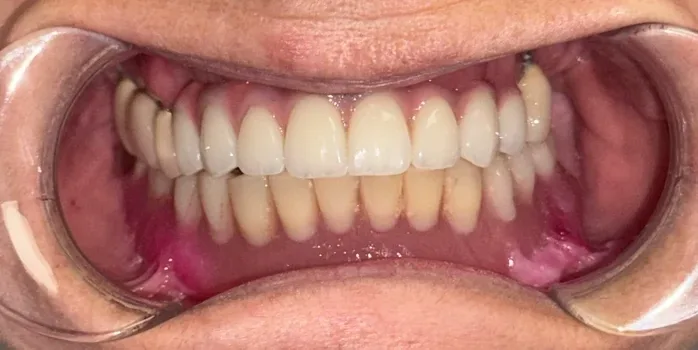 Denteca Smile Clinic - stomatologie premium București