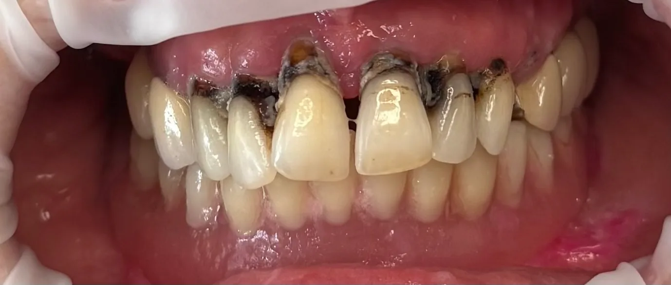 Denteca Smile Clinic - stomatologie premium București