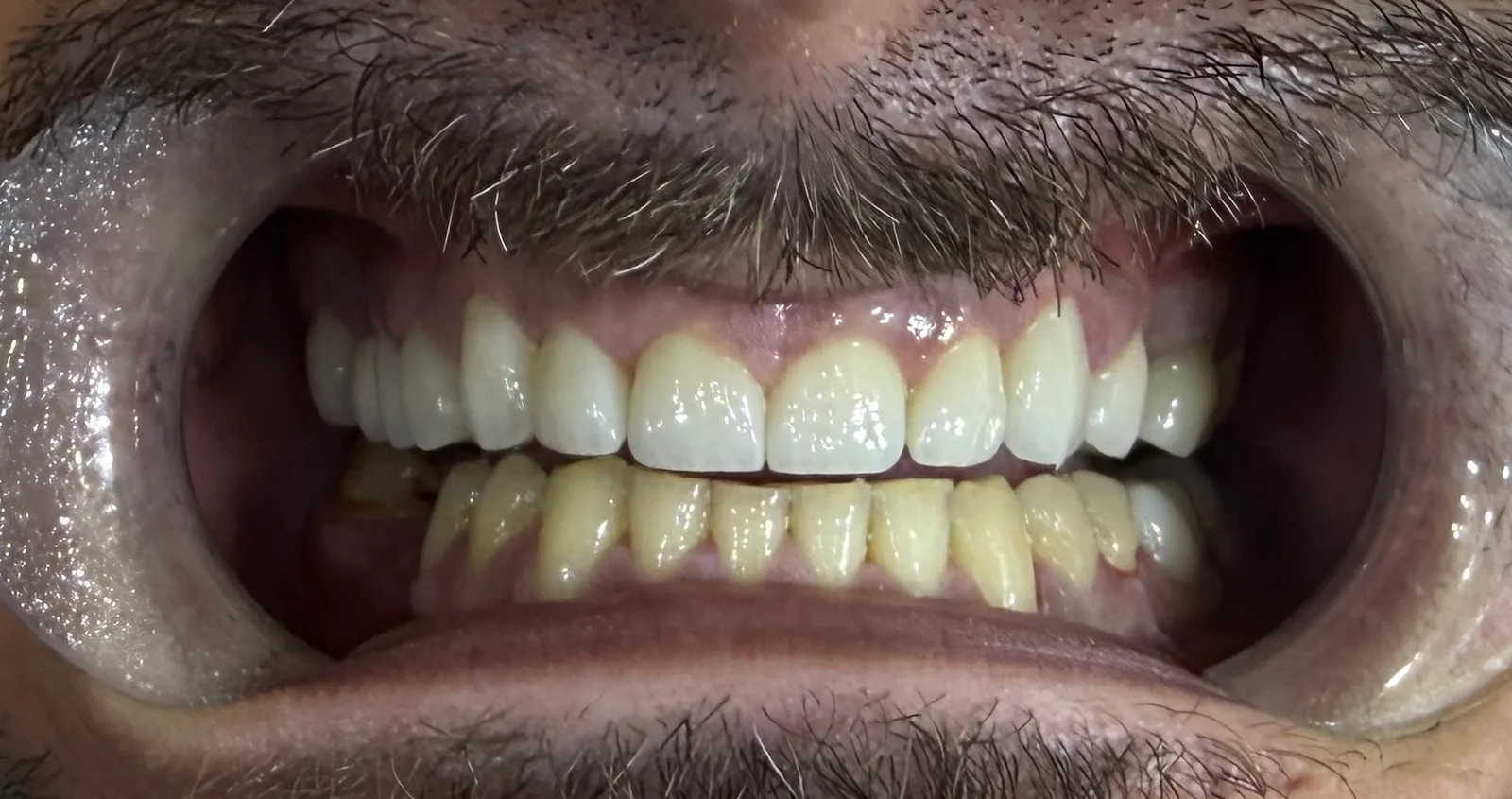 Denteca Smile Clinic - stomatologie premium București