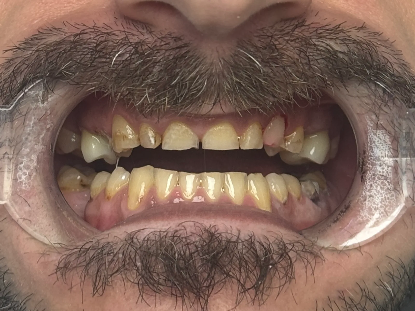 Denteca Smile Clinic - stomatologie premium București