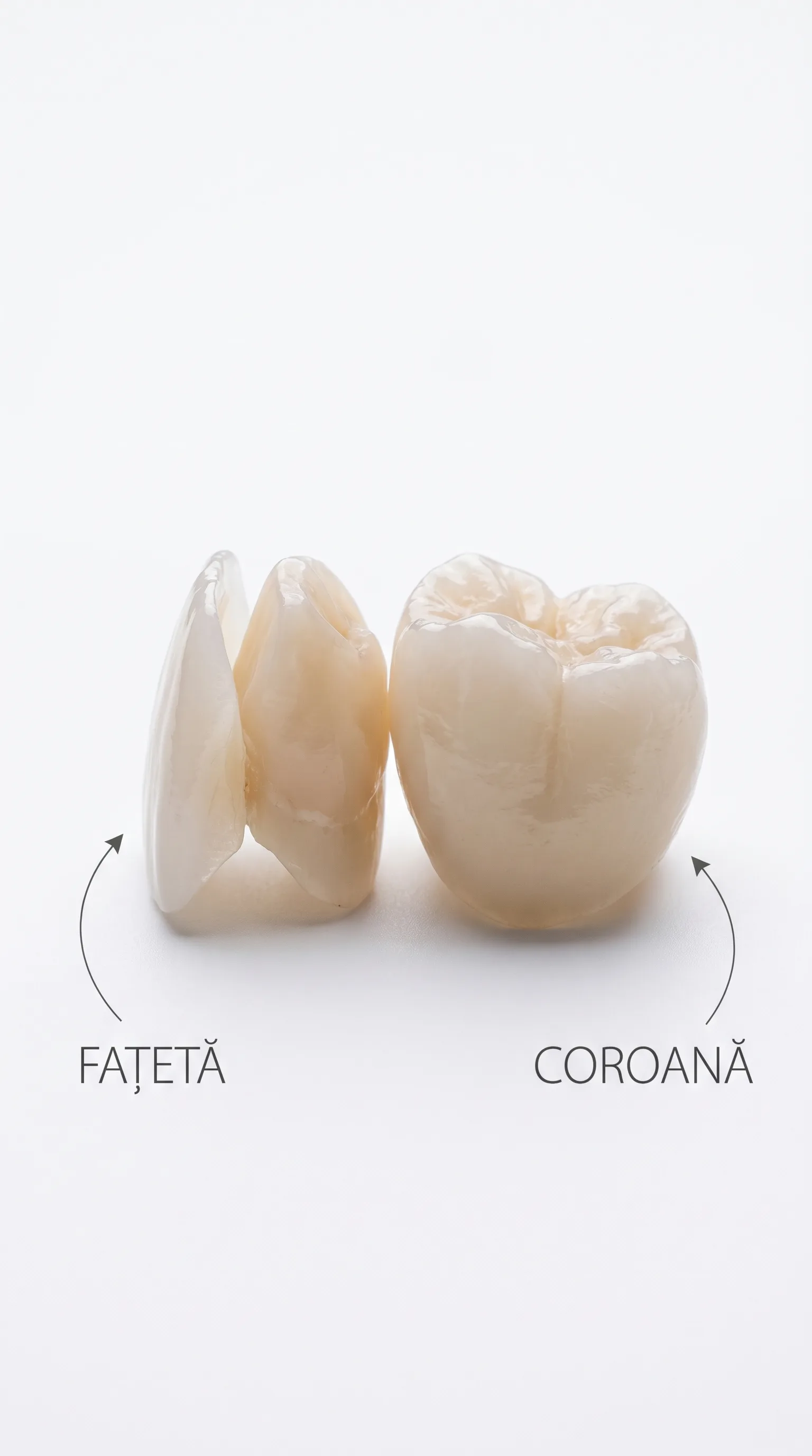 Fațetă vs. Coroană Dentară - Denteca București Comparație fațetă ceramică vs coroană dentară - diferențe vizuale