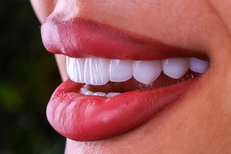Digital Smile Design: cum se planifică un zâmbet nou