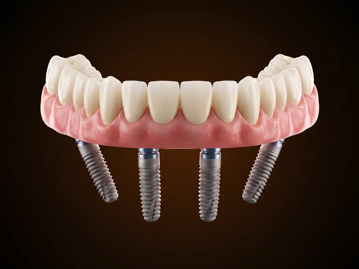 Denteca Smile Clinic Denteca Smile Clinic - stomatologie premium București