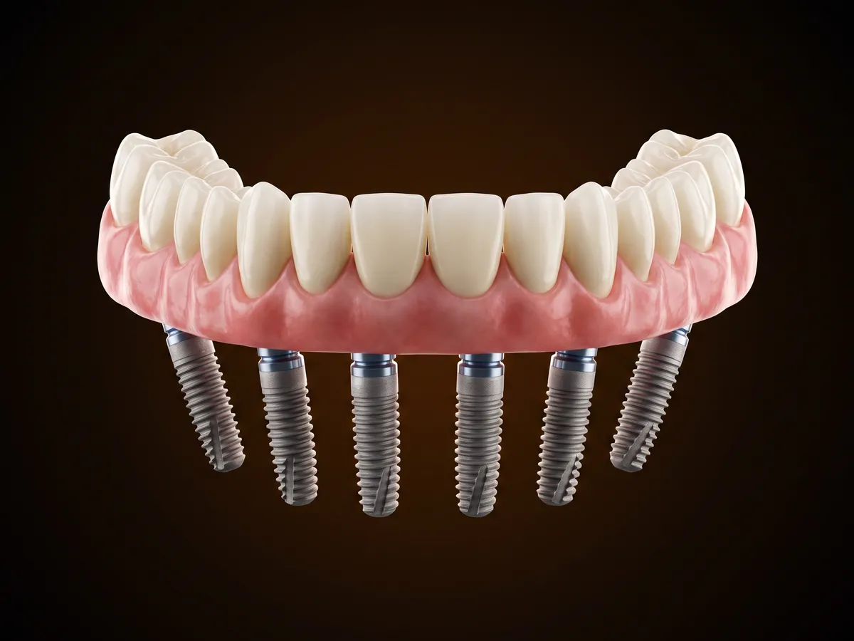 Denteca Smile Clinic Denteca Smile Clinic - stomatologie premium București