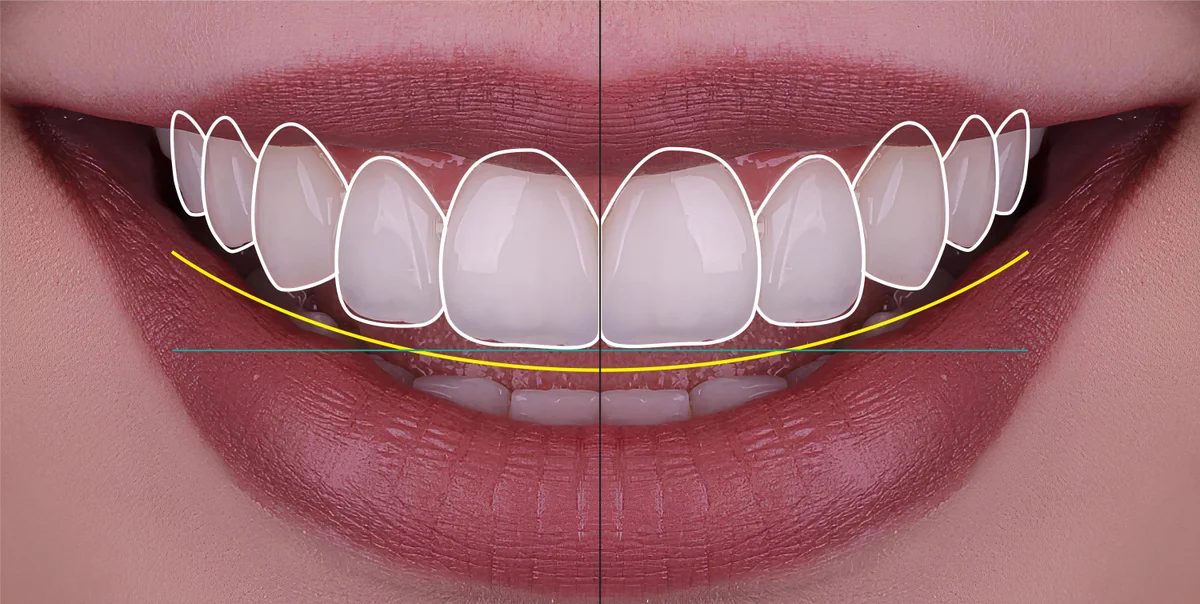 Design digital al zâmbetului la Denteca Smile Clinic București