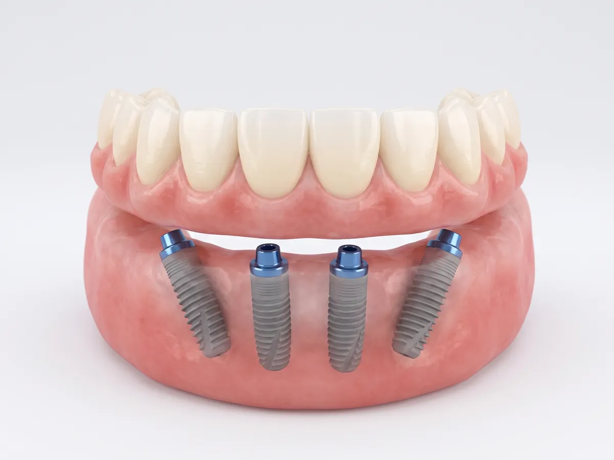 Denteca Smile Clinic Denteca Smile Clinic - stomatologie premium București
