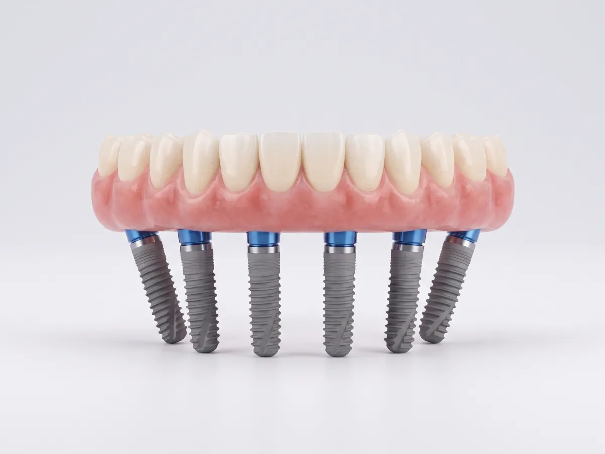 Denteca Smile Clinic Denteca Smile Clinic - stomatologie premium București