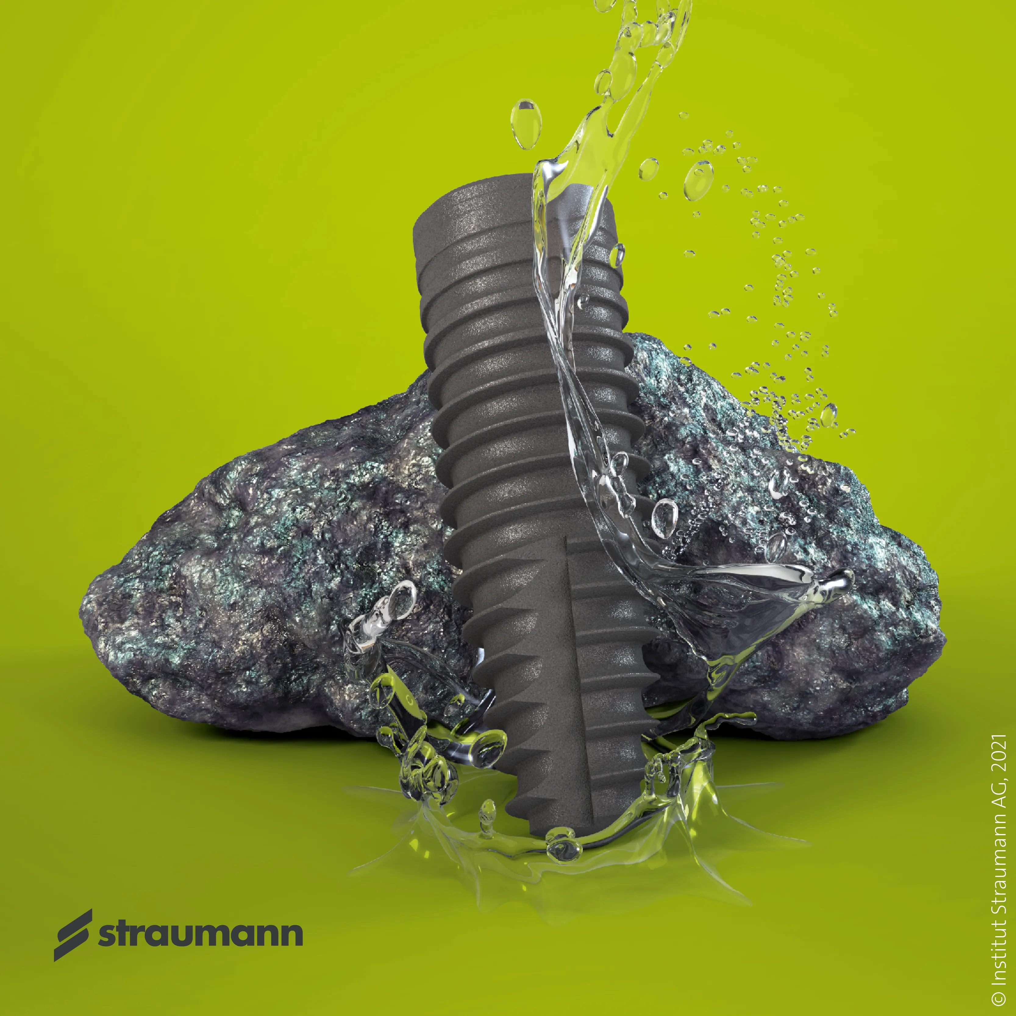 Roxolid - materialul implantului Straumann BLX Implant Straumann din aliaj Roxolid, rezistență mecanică crescută - Denteca Smile Clinic