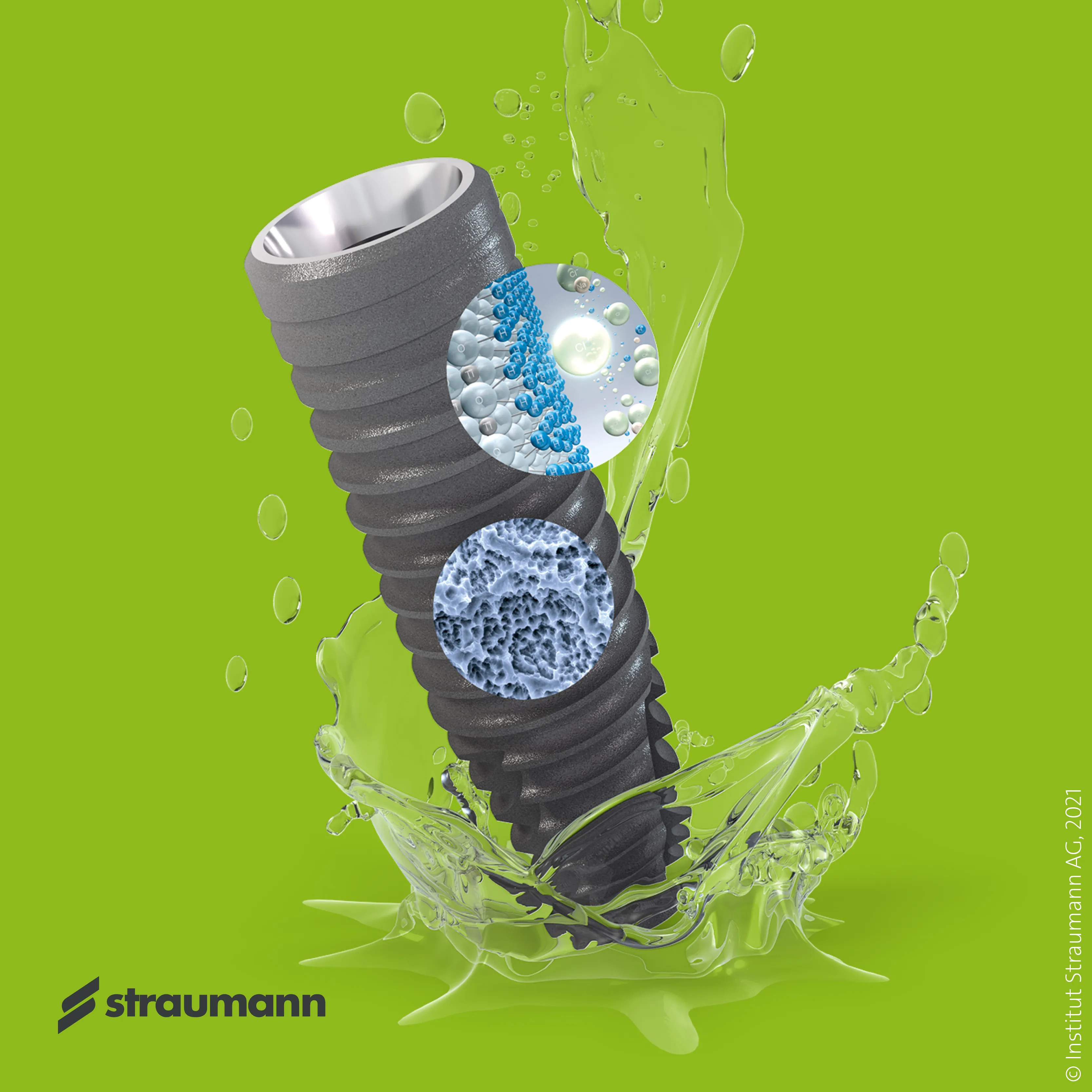 SLActive - suprafața implantului Straumann BLX Detaliu microscopic suprafață SLActive a implantului Straumann - Denteca Smile Clinic